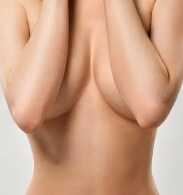 Paul Wilson Aesthetics - Breast Uplift