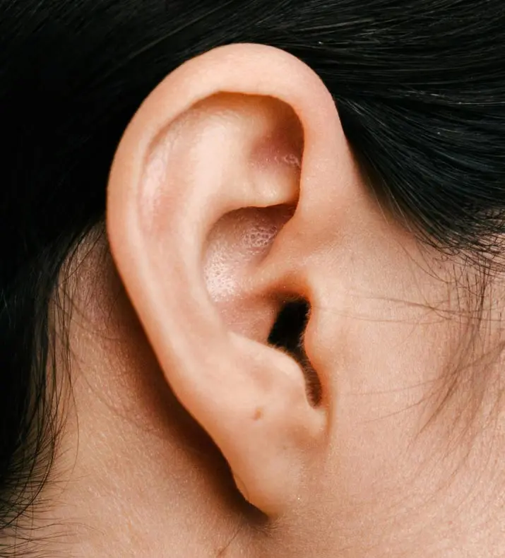 Paul Wilson Aesthetics - Ear Reshaping Post Op Recovery