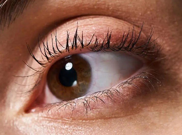 Paul Wilson Aesthetics - Eyelid Surgery Procedure Video