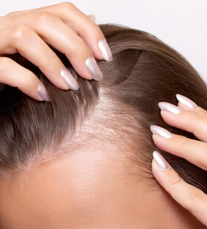 Paul Wilson Aesthetics - Hairline Lowering Treatment Overview