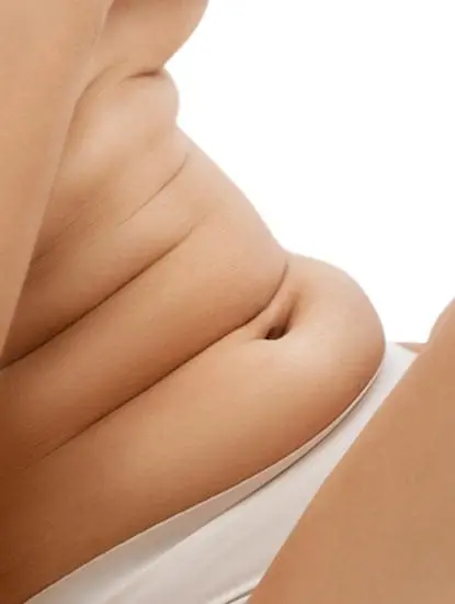 Paul Wilson Aesthetics - Liposuction Benefits 1