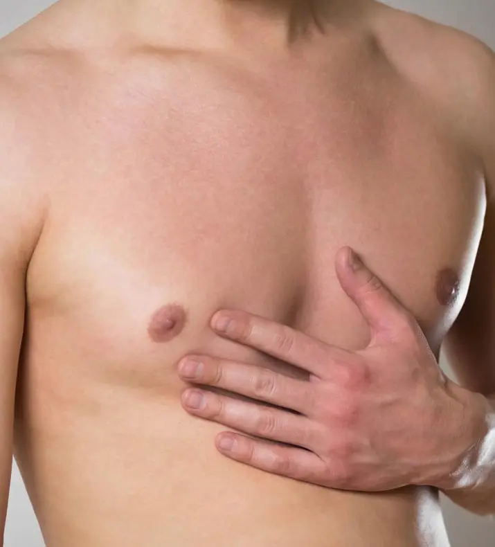 Paul Wilson Aesthetics - Male Breast Reduction Treatment Overview