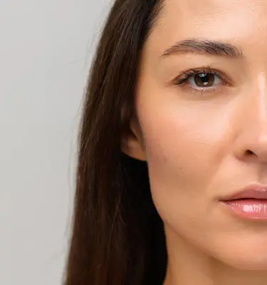 Paul Wilson Aesthetics - Secondary Rhinoplasty