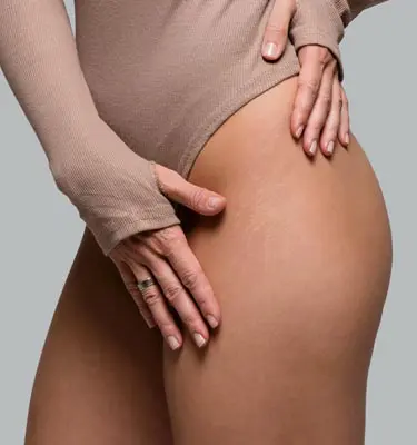 Paul Wilson Aesthetics - Thigh Lift