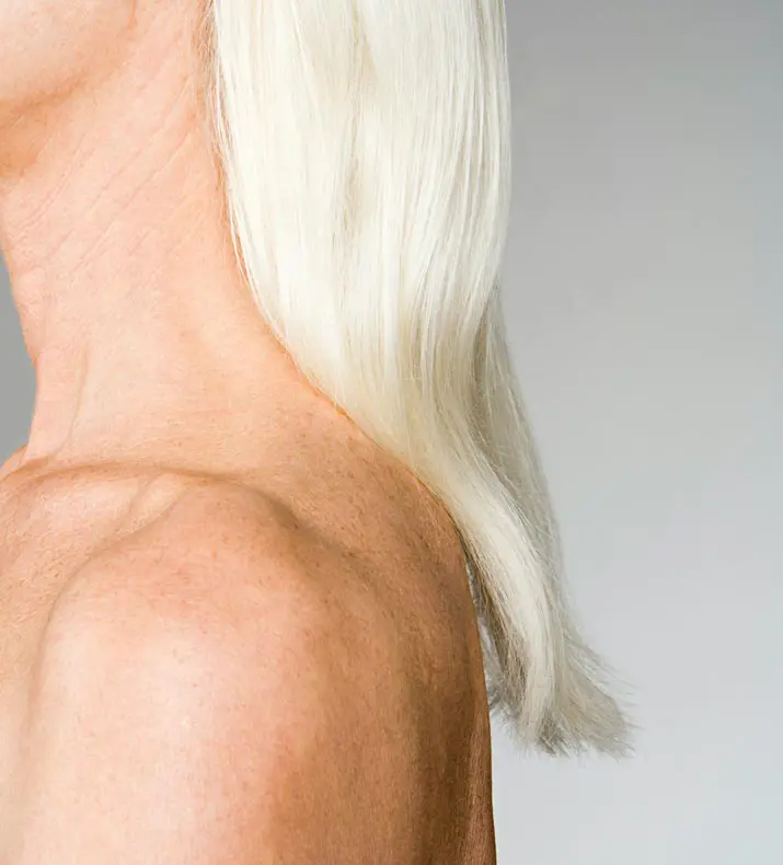 Paul Wilson Aesthetics - Wrinkle Reduction Injections Post Op Recovery