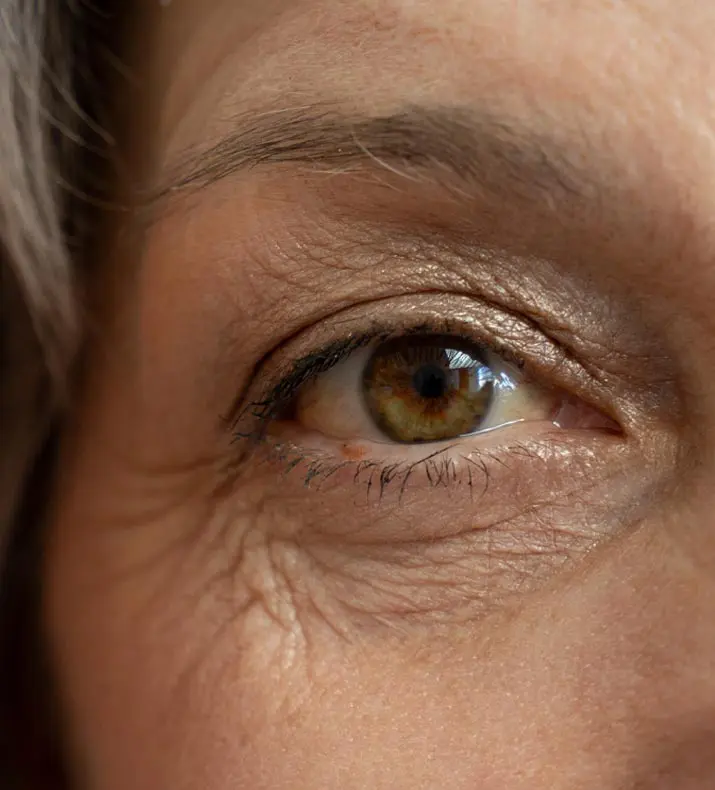 Paul Wilson Aesthetics Wrinkle Treatment Overview Injections