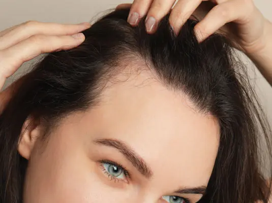 Mr Paul Wilson - Hairline Lowering (Foreheadplasty) Spotlight