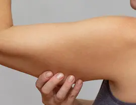 Arm Lift Surgery | Brachioplasty | Arm Reduction Surgery