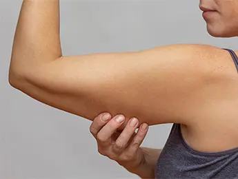 Arm Lift Surgery | Brachioplasty | Arm Reduction Surgery