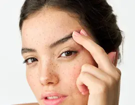 Brow Lift Surgery | Brow Lift | Brow Lift Before and After