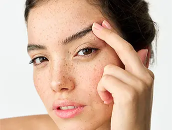 Brow Lift Surgery | Brow Lift | Brow Lift Before and After