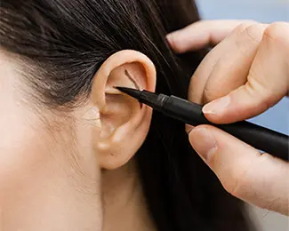 Otoplasty Surgery | Otoplasty | Otoplasty Cost UK