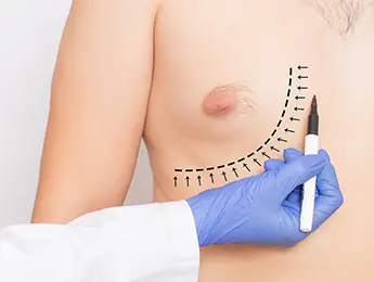 Gynecomastia Surgery | Gynecomastia Surgery Cost | Male Breast Reduction Surgery