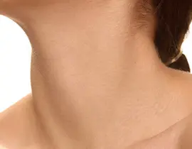 Neck Lift Surgery | Neck Lift | Neck Lift Procedure