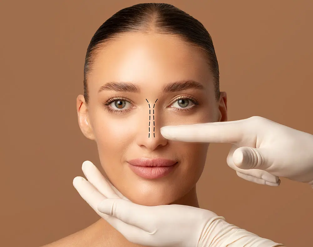 Rhinoplasty Surgery | Rhinoplasty | Rhinoplasty UK | Nose Rhinoplasty