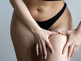 Thigh Liposuction | Thigh Reduction | Thigh Reduction Surgery