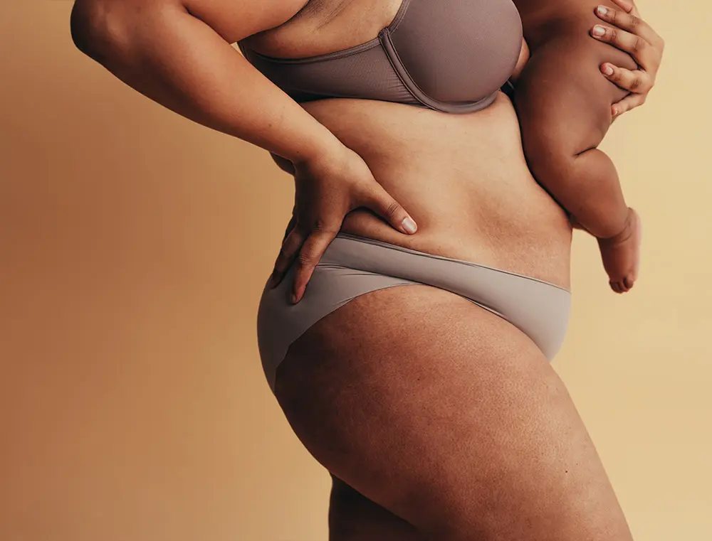 Mummy Makeover UK | Mummy Makeover Surgery | Best Mummy Makeover UK