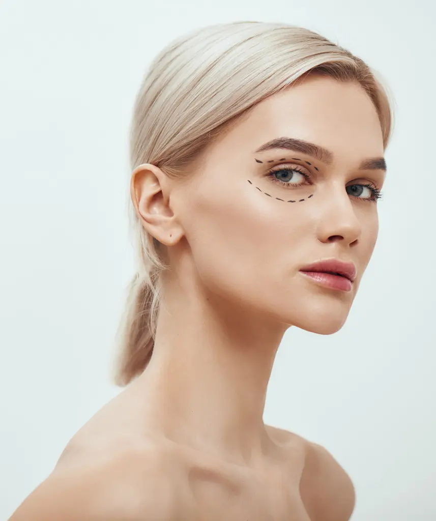 Blepharoplasty Surgery | Eyelid Surgery | Blepharoplasty