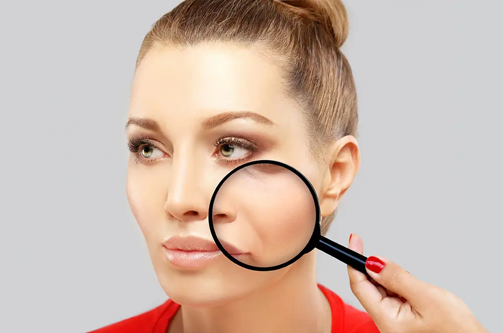 Nasolabial Folds | Nasolabial Folds Treatment | Best Treatment for Nasolabial Folds