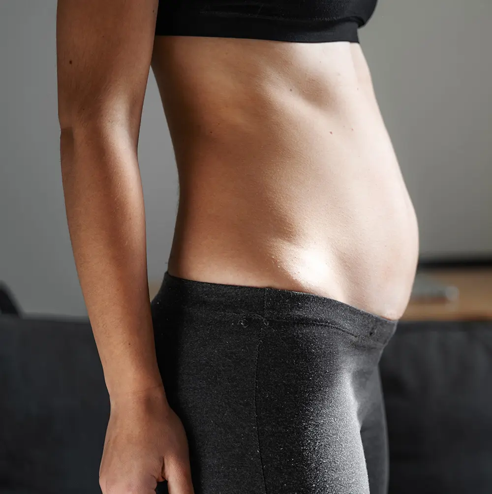 Diastasis Recti | Diastasis Recti Surgery | Diastasis Recti Symptoms