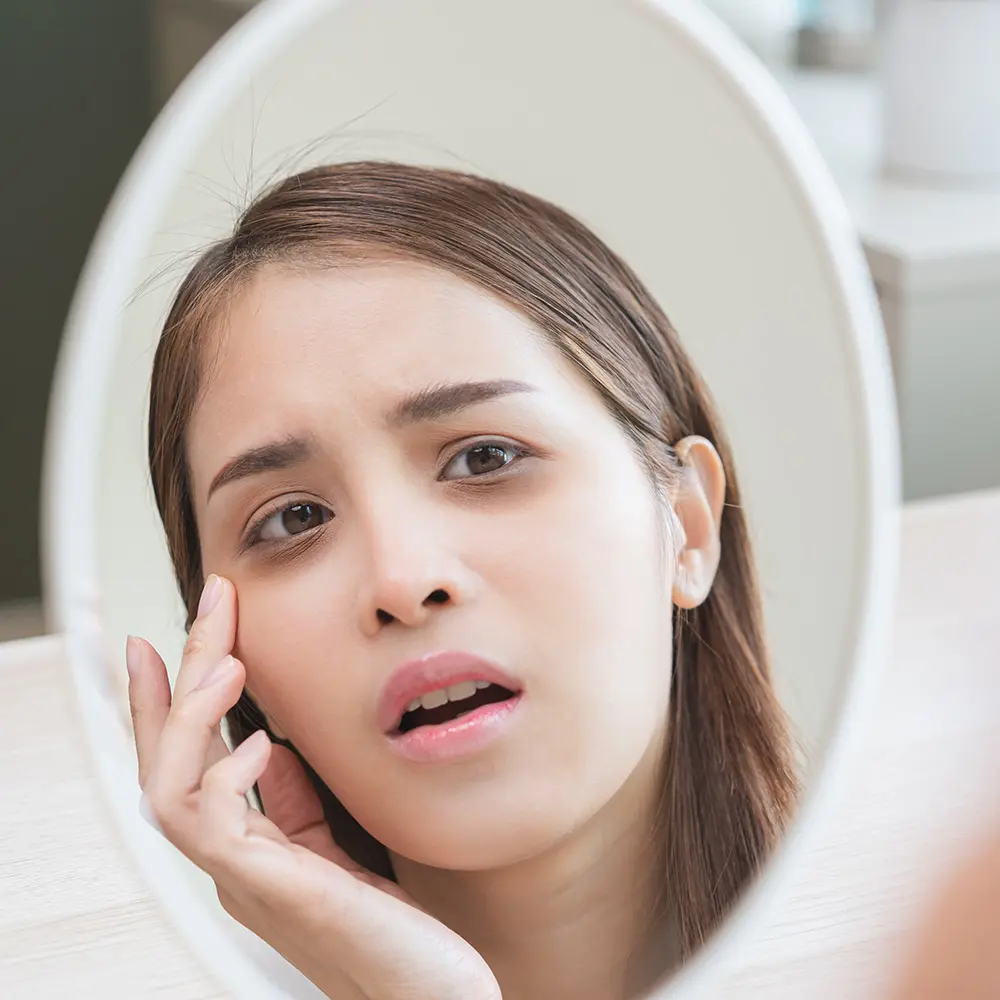 Bags Under Eyes | Bags Under Eyes Treatment | Dark Bags Under Eyes