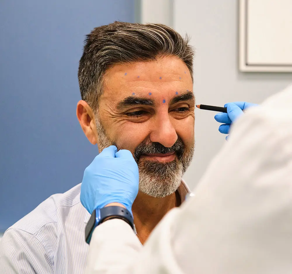 Crows Feet | Crows Feet Treatment | How to Get Rid of Crows Feet