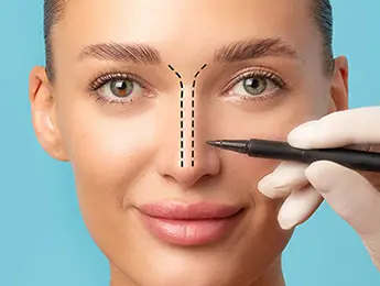 Open Rhinoplasty | Open Rhinoplasty Procedure | What is Open Rhinoplasty | Open Rhinoplasty Scar