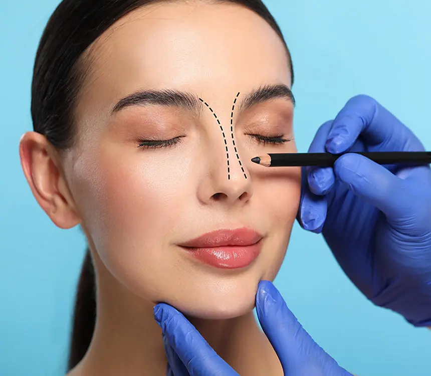 Open vs Closed Rhinoplasty | Closed vs Open Rhinoplasty | Difference Between Open and Closed Rhinoplasty