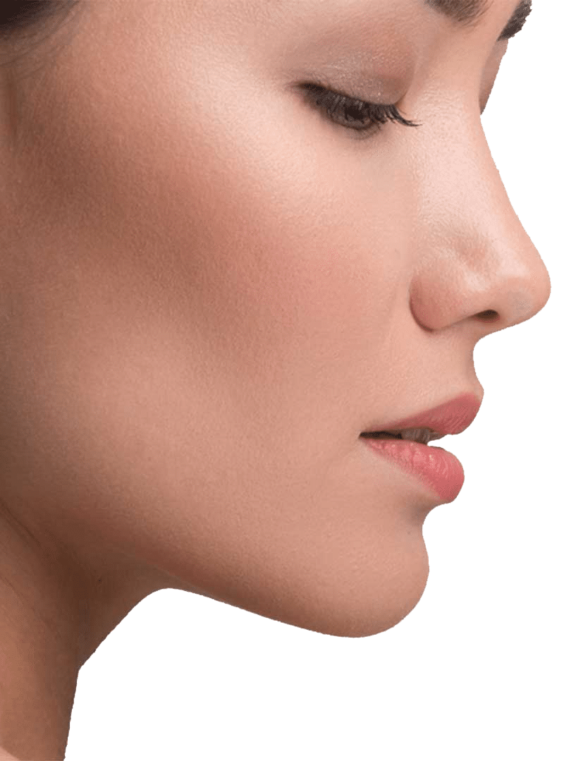 Woman Rhinoplasty Trans